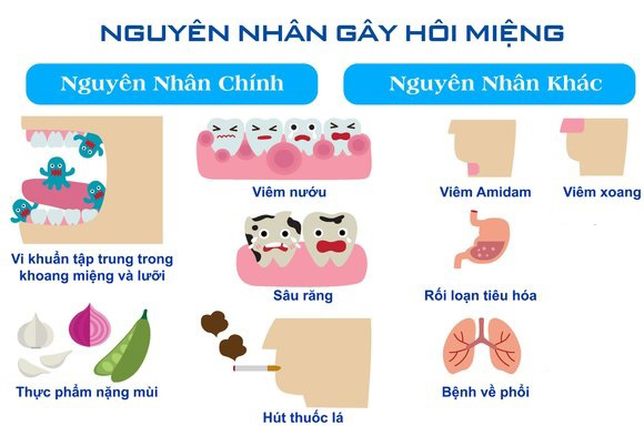 Những Nguyên Nhân Gây Hôi Miệng Mà Mọi Người Nên Biết