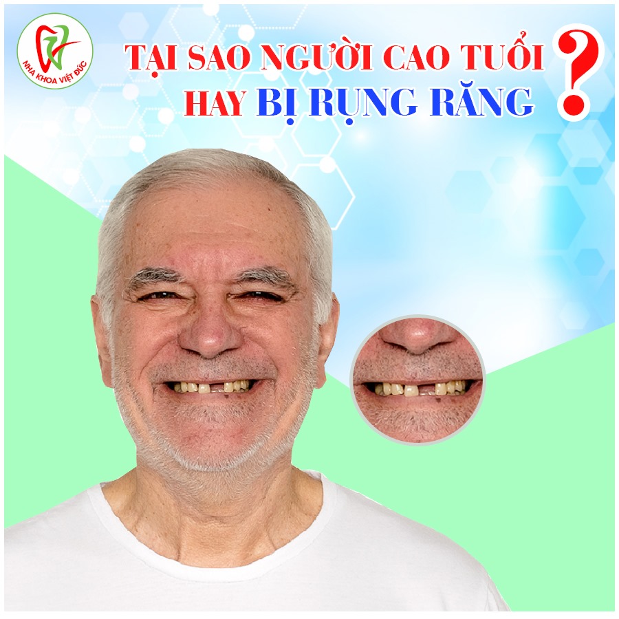 TẠI SAO NGƯỜI CAO TUỔI HAY BỊ RỤNG RĂNG?