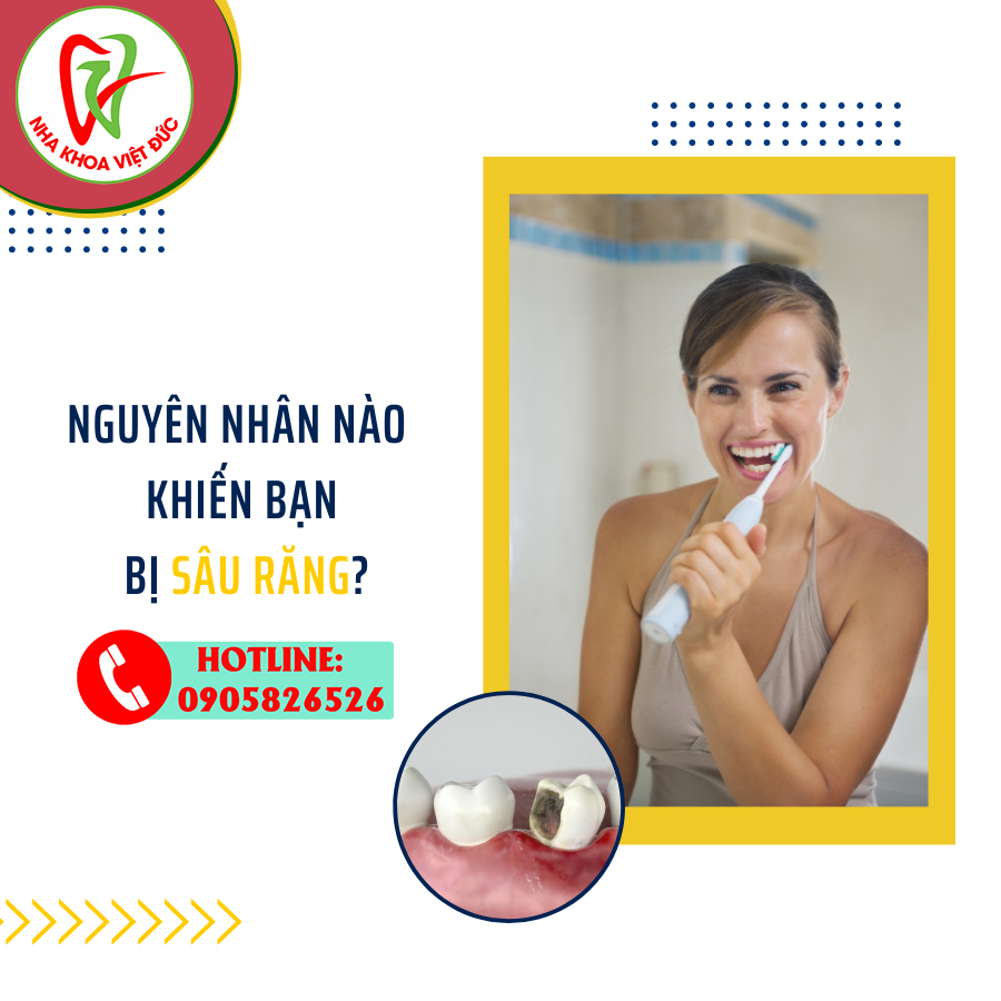 NHỮNG NGUYÊN NHÂN NÀO KHIẾN BẠN BỊ SÂU RĂNG?