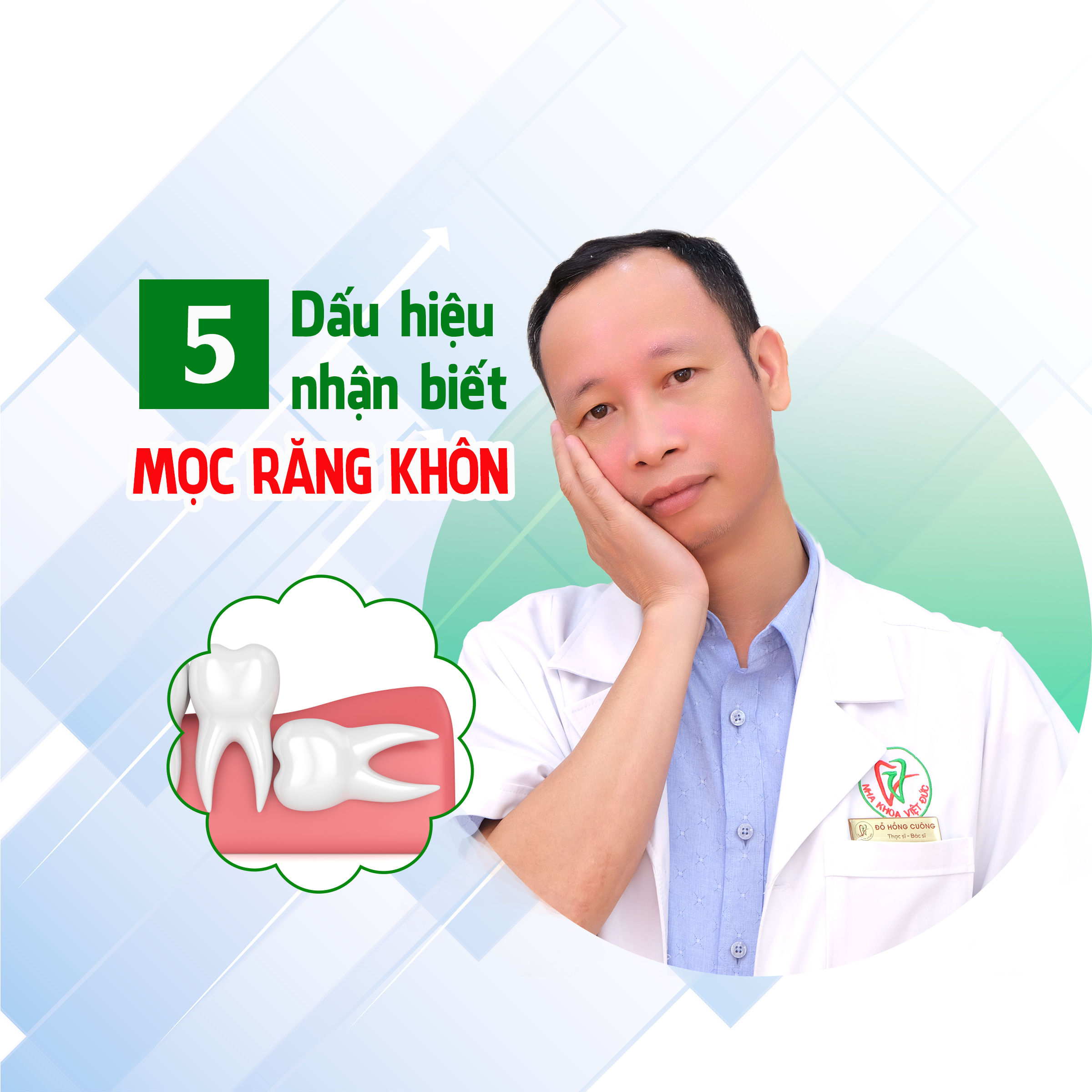 5 DẤU HIỆU NHẬN BIẾT MỌC RĂNG KHÔN