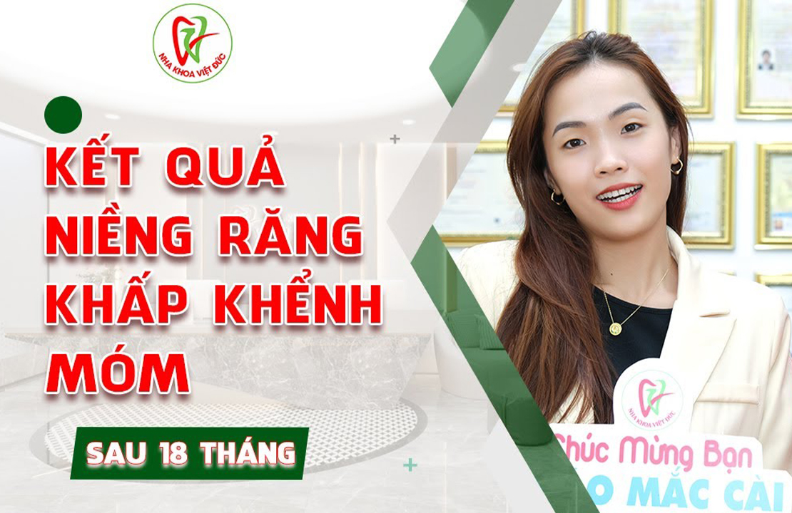 Khách hàng Nhật Yến