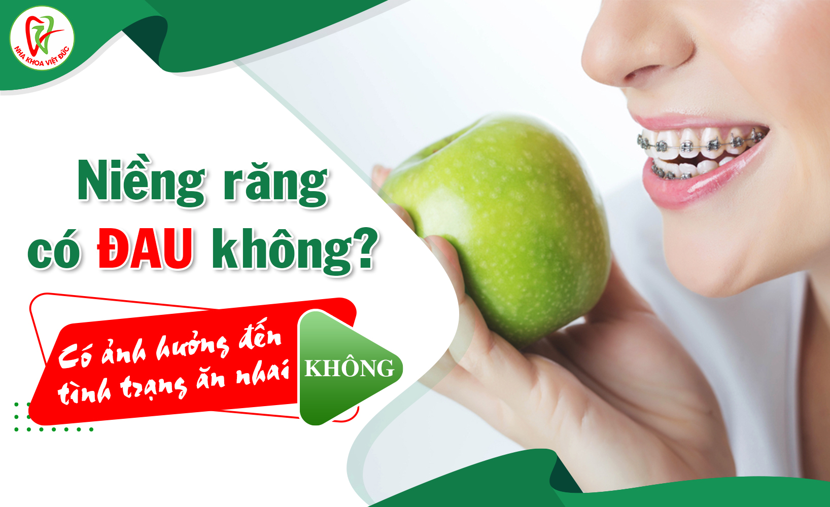 Niềng răng có đau không? Có ảnh hưởng đến tình trạng ăn nhai không?