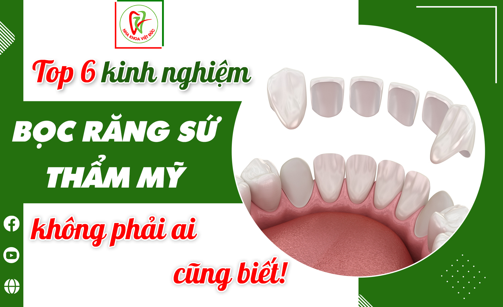 TOP 6 KINH NGHIỆM BỌC RĂNG SỨ THẨM MỸ KHÔNG PHẢI AI CŨNG BIẾT