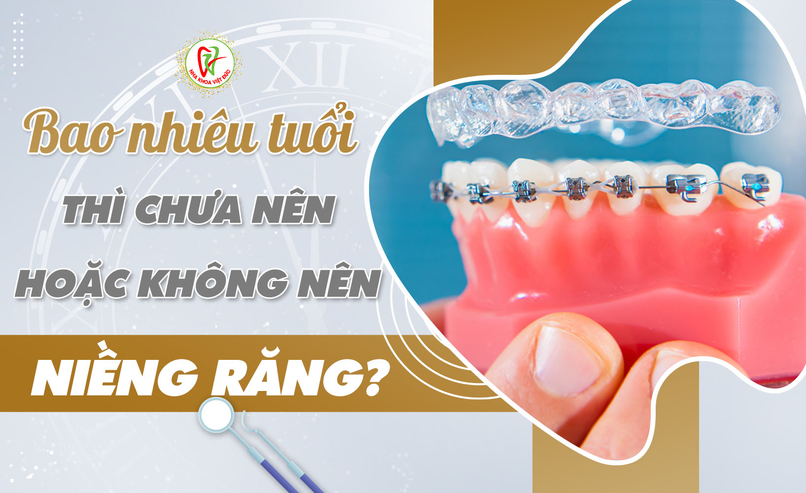 BAO NHIÊU TUỔI THÌ CHƯA NÊN HOẶC KHÔNG NÊN NIỀNG RĂNG?